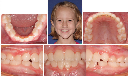 before and after