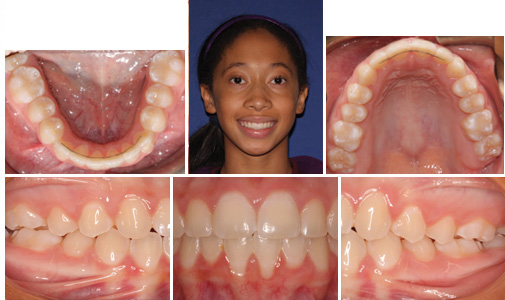 before and after