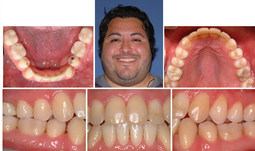 before and after