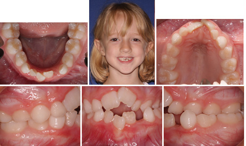before and after