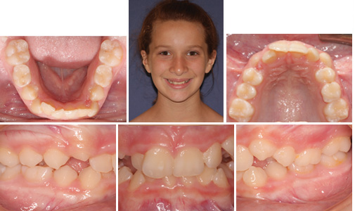 before and after