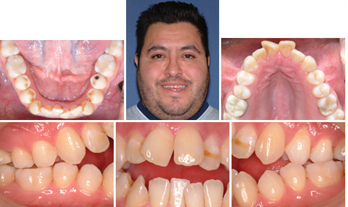 before and after