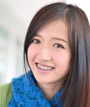 orthodontic faqs